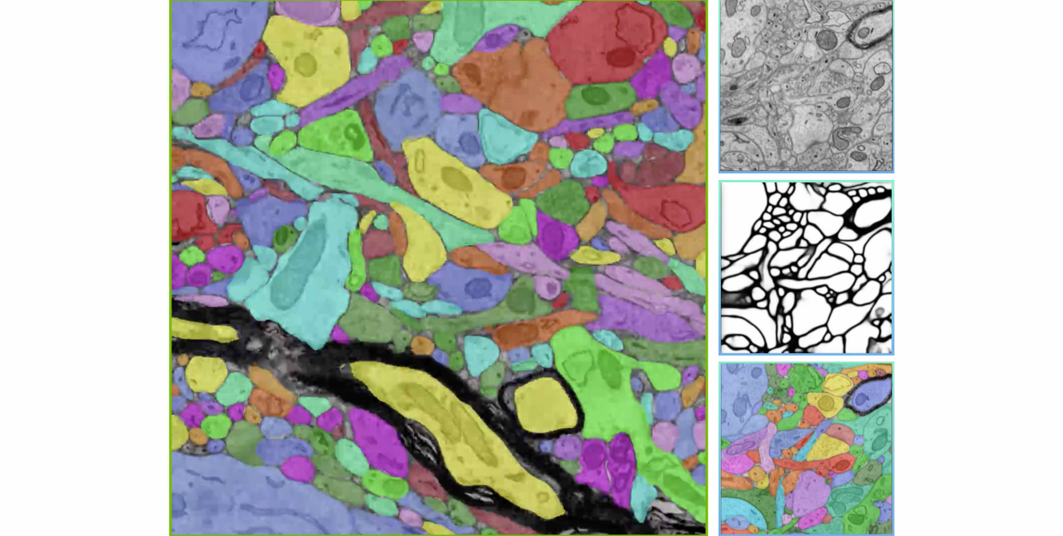 Neural Circuit Segmentation